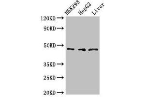 Western Blot Positive WB detected in: HEK293 whole cell lysate, HepG2 whole cell lysate, Rat liver tissue All lanes: ACADSB antibody at 3 μg/mL Secondary Goat polyclonal to rabbit IgG at 1/50000 dilution Predicted band size: 48, 37 kDa Observed band size: 48 kDa (ACADSB anticorps  (AA 34-253))