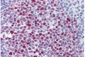 Human Tonsil: Formalin-Fixed, Paraffin-Embedded (FFPE)