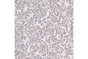 Immunohistochemistry (IHC) image for anti-Breast Carcinoma Amplified Sequence 2 (BCAS2) (C-Term) antibody (ABIN7453423)