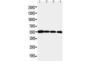 Anti-MMP24 antibody, Western blotting Lane 1: PANC Cell Lysate Lane 2: HELA Cell Lysate Lane 3: SMMC Cell Lysate Lane 4: A549 Cell Lysate (MMP24 anticorps  (N-Term))