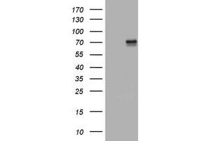 Image no. 6 for anti-Tumor Necrosis Factor Receptor Superfamily, Member 8 (TNFRSF8) (AA 19-379) antibody (ABIN1491087) (TNFRSF8 anticorps  (AA 19-379))