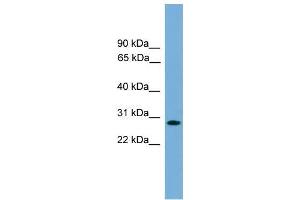 Human Jurkat; WB Suggested Anti-APOLD1 Antibody Titration: 0. (APOLD1 anticorps  (Middle Region))