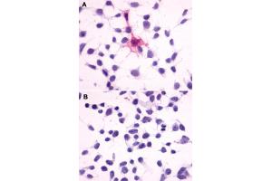 Immunocytochemistry (ICC) staining of HEK293 human embryonic kidney cells transfected (A) or untransfected (B) with MC4R. (MC4R anticorps  (Extracellular Domain))