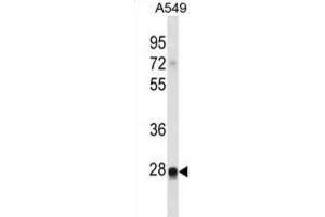 Western Blotting (WB) image for anti-Ras-Like Without CAAX 2 (RIT2) antibody (ABIN2998826) (RIT2 anticorps)