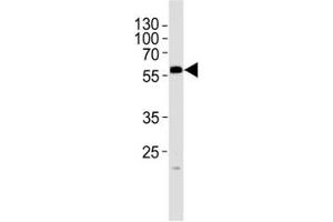 Western blot analysis of lysate from mouse testis tissue lysate using PHF1 antibody at 1:1000.