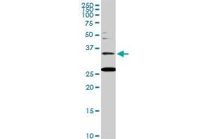 BARHL1 monoclonal antibody (M01), clone 2B11. (BARHL1 anticorps  (AA 55-154))