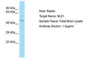 Image no. 1 for anti-Notchless Homolog 1 (NLE1) (C-Term) antibody (ABIN6750002)