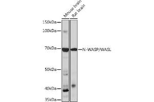 Western blot analysis of extracts of various cell lines, using N-WASP/N-WASP/WASL Rabbit mAb (ABIN7268856) at 1:1000 dilution. (Neural Wiskott-Aldrich syndrome protein (WASL) anticorps)