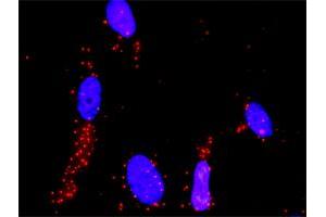 Proximity Ligation Analysis of protein-protein interactions between MAP2K3 and MAP3K4.