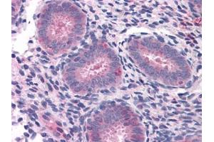 Human Uterus: Formalin-Fixed, Paraffin-Embedded (FFPE) (ELP3/KAT9 anticorps)