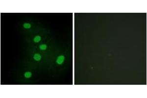 Immunofluorescence analysis of HepG2 cells, using NR2F6 Antibody.