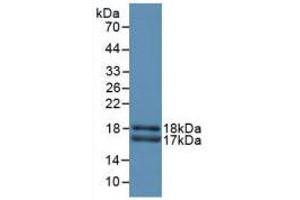 Western blot analysis of recombinant Rat CEACAM1. (CEACAM1 anticorps  (AA 36-145))