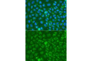 Immunofluorescence analysis of A549 cell using SRGN antibody. (SRGN anticorps)