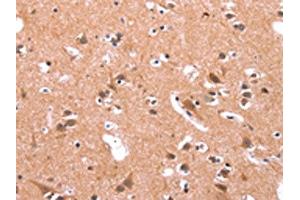 The image on the left is immunohistochemistry of paraffin-embedded Human brain tissue using ABIN7190731(GABRA1 Antibody) at dilution 1/30, on the right is treated with synthetic peptide.