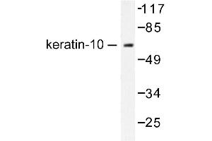 Image no. 1 for anti-Keratin 10 (KRT10) antibody (ABIN265492) (Keratin 10 anticorps)