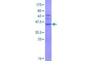 Image no. 1 for Ring Finger Protein 122 (RNF122) (AA 1-155) protein (GST tag) (ABIN1318212)