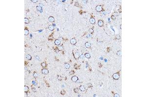 Immunohistochemistry of paraffin-embedded rat brain using Cathepsin B Rabbit pAb (ABIN3021175, ABIN3021176, ABIN3021177 and ABIN6214050) at dilution of 1:100 (40x lens). (Cathepsin B anticorps  (AA 1-339))
