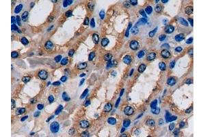 Detection of FABP1 in Mouse Kidney Tissue using Polyclonal Antibody to Fatty Acid Binding Protein 1 (FABP1)