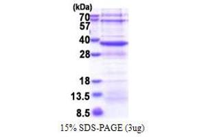 SDS-PAGE (SDS) image for NAD(P) Dependent Steroid Dehydrogenase-Like (NSDHL) (AA 1-297) protein (His tag) (ABIN6387344) (NSDHL Protein (AA 1-297) (His tag))