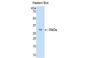 Western Blotting (WB) image for anti-Complement Factor D (CFD) (AA 1-259) antibody (ABIN3205986) (Adipsin anticorps  (AA 1-259))