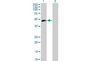 Western Blot analysis of MEIS3 expression in transfected 293T cell line by MEIS3 MaxPab polyclonal antibody. (MEIS3 anticorps  (AA 1-421))