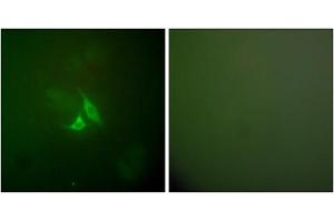 Immunofluorescence analysis of A549 cells, using PTGS2 antibody (ABIN5976369). (PTGS2 anticorps  (C-Term))