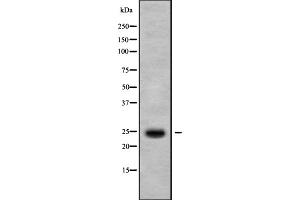 Western blot analysis IL1F7 using HepG2 whole cell lysates (IL-37 anticorps  (N-Term))