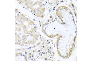 Immunohistochemistry of paraffin-embedded human stomach using INPP5K antibody (ABIN5975191) at dilution of 1/100 (40x lens). (INPP5K anticorps)