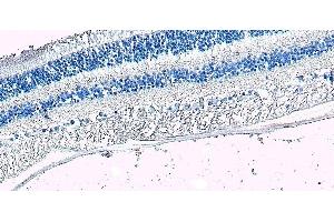 (ABIN570667) Negative Control showing staining of paraffin embedded Human Retina, with no primary antibody. (ARR3 anticorps  (C-Term))