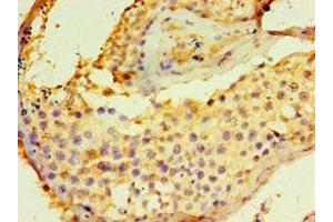 Immunohistochemistry of paraffin-embedded human testis tissue using ABIN7149845 at dilution of 1:100 (DGKE anticorps  (AA 40-260))