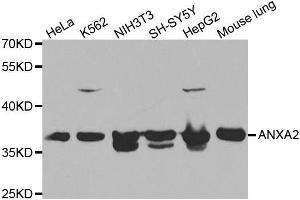 Western blot analysis of extracts of various cell lines, using ANXA2 antibody. (Annexin A2 anticorps)
