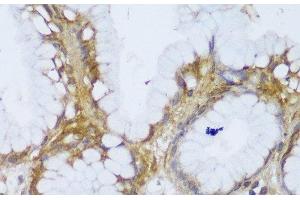 Immunohistochemistry of paraffin-embedded Human stomach using GCC2 Polyclonal Antibody at dilution of 1:150 (40x lens).