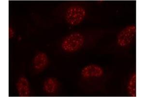 Image no. 1 for anti-Mitogen-Activated Protein Kinase-Activated Protein Kinase 2 (MAPKAPK2) (pThr334) antibody (ABIN197078) (MAPKAP Kinase 2 anticorps  (pThr334))