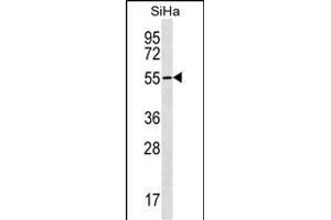 RN Antibody (N-term) (ABIN1539491 and ABIN2849873) western blot analysis in SiHa cell line lysates (35 μg/lane).