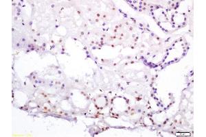 Formalin-fixed and paraffin embedded human kidney labeled with Anti-HNF4/TCF4/HNF4A Polyclonal Antibody, Unconjugated (ABIN704711) at 1:200 followed by conjugation to the secondary antibody and DAB staining (HNF4A anticorps  (AA 301-400))