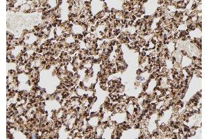 ABIN6272996 at 1/100 staining Rat lung tissue by IHC-P.