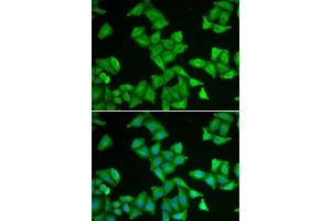 Immunofluorescence analysis of U2OS cells using COX5A antibody (ABIN6130953, ABIN6138912, ABIN6138913 and ABIN6222082).