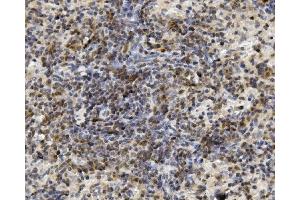 IHC analysis of U2AF2 using anti-U2AF2 antibody (ABIN7600793). (U2AF2 anticorps  (AA 238-470))