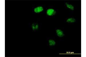 Immunofluorescence of purified MaxPab antibody to ZBTB3 on HeLa cell. (ZBTB3 anticorps  (AA 1-574))