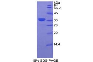 SDS-PAGE analysis of Rat BST1 Protein.