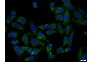 Human U2-OS cells were stained with Osteocalcin Polyclonal Antibody, Unconjugated at 1:200 in PBS and incubated for two hours at 37°C followed by Goat Anti-Rabbit IgG (H+L) FITC conjugated secondary antibody.