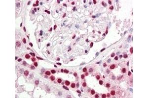 IHC staining of FFPE human kidney at 2. (IRF6 anticorps)