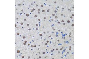 Immunohistochemistry of paraffin-embedded rat liver using MTA3 antibody (ABIN2737194) at dilution of 1:100 (40x lens). (MTA3 anticorps)