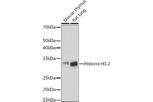 Western blot analysis of extracts of various cell lines, using Histone H1. (HIST1H1C anticorps)