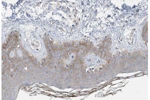 ABIN6266872 at 1/100 staining human Skin tissue sections by IHC-P. (COL14A1 anticorps  (C-Term))