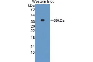 Western blot analysis of the recombinant protein. (STK3 anticorps  (AA 235-460))
