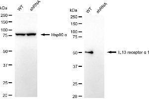 anti-Interleukin 13 Receptor, alpha 1 (IL13RA1) antibody