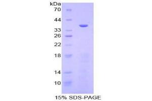 SDS-PAGE (SDS) image for Meprin A, alpha (PABA Peptide Hydrolase) (MEP1A) (AA 213-506) protein (His tag) (ABIN2125845)