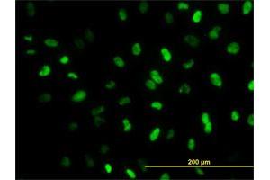 Immunofluorescence of monoclonal antibody to MEIS2 on HeLa cell.