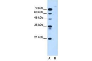 Image no. 1 for anti-Ubiquitin Specific Peptidase 48 (USP48) (AA 171-220) antibody (ABIN205064) (USP48 anticorps  (AA 171-220))